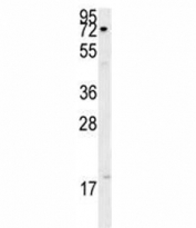 XRCC1 antibody western blot analysis in A375 lysate. Rountinely observed molecular weight: 69~90 kDa.