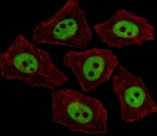 Immunofluorescent analysis of A549 cells using XRCC1 antibody at 1:25. Alexa Fluor 488-conjugated secondary was used (green). Cytoplasmic actin was counterstained with Dylight Fluor 554 conjugated Phalloidin (red).