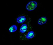 Confocal immunofluorescent analysis of FOXP2 antibody with HepG2 cells followed by Alexa Fluor 488-conjugated goat anti-rabbit lgG (green). DAPI was used as a nuclear counterstain (blue).