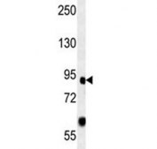 FOXP2 antibody western blot analysis in mouse heart lysate. Predicted molecular weight: ~80 kDa.