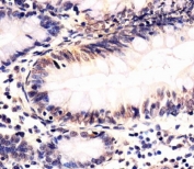 IHC staining of FFPE human colon tissue with SOX10 antibody. HIER: boil tissue sections in pH6, 10mM citrate buffer, for 10-20 min followed by cooling at RT for 20 min.
