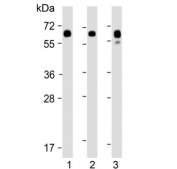 Western blot testing of human 1) fetal liver, 2) lung and 3) placenta lysate with PPARG antibody at 1:2000. Expected molecular weight: 54-57 kDa.