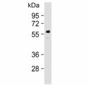 Western blot testing of human lung lysate with PPARG antibody at 1:2000. Expected molecular weight: 54-57 kDa.