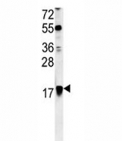 ARF1 antibody western blot analysis in Ramos lysate. Predicted molecular weight ~21kDa.