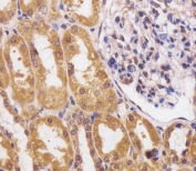 IHC staining of FFPE human kidney with CUX1 antibody at 1:25. HIER: boil tissue sections in pH6, 10mM citrate buffer, for 10-20 min and allow to cool before testing.