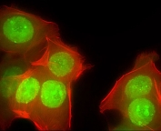 Fluorescent staining of human MCF-7 cells with CUX1 antibody. Cells were fixed with 4% PFA (20 min), permeabilized with Triton X-100 (0.1%, 10 min), then incubated with primary Ab (1:25, 1 h at 37oC). Green = CUX1 antibody, Red = Phalloidin stained actin.