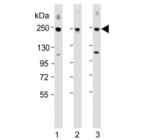 Western blot testing of human 1) MCF-7, 2) MOLT-4 and 3) SH-SY5Y cell lysate with CUX1 antibody at 1:2000. Expected molecular weight ~200 kDa with smaller isoforms.