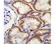 IHC staining of FFPE human kidney with CUX1 antibody at 1:25. HIER: boil tissue sections in pH6, 10mM citrate buffer, for 10-20 min and allow to cool before testing.