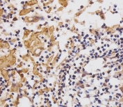 IHC staining of FFPE human lymph node with CUX1 antibody at 1:25. HIER: boil tissue sections in pH6, 10mM citrate buffer, for 10-20 min and allow to cool before testing.