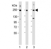 Western blot testing of human 1) MCF-7, 2) MOLT-4 and 3) SH-SY5Y cell lysate with CUX1 antibody at 1:2000. Expected molecular weight ~200 kDa with smaller isoforms.
