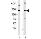 Western blot testing of human 1) HEK293 and 2) K562 cell lysate with CUX1 antibody at 1:2000. Expected molecular weight ~200 kDa with smaller isoforms.