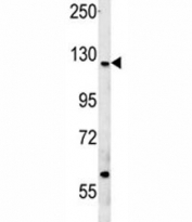 Western blot testing of human MCF7 cell lysate with CUX1 antibody at 1:2000. Expected molecular weight ~200 kDa with smaller isoforms.