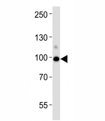Western blot analysis of lysate from human kidney tissue lysate using ACE2 antibody diluted at 1:1000. Predicted molecular weight: 90-100 kDa.~