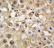 IHC analysis of FFPE human testis tissue stained with Angiotensin-converting enzyme 2 antibody
