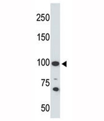 Western blot testing of Angiotensin-converting enzyme 2 antibody and 293 cell lysate. Predicted molecular weight: 90-100 kDa.
