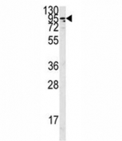 Western blot analysis of the Angiotensin-converting enzyme 2 antibody in K562 lysate. Predicted molecular weight: 90-100 kDa.