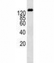 P-Glycoprotein antibody western blot analysis in K562 lysate. Expected molecular weight: 141-180 kDa depending on glycosylation level.