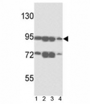 Western blot analysis of ABCB5 antibody and 1) A375, 2) K562, 3) A2058 and4)  HL-60 lysate. Predicted molecular weight ~90kDa.