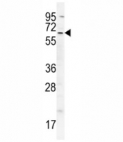 cIAP2 antibody western blot analysis in A549 lysate