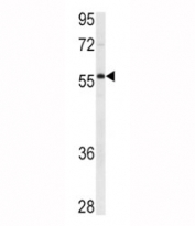 Western blot analysis of XIAP antibody and Ramos lysate. Expected/observed molecular weight ~57 kDa.