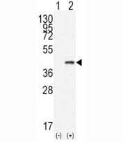 Western blot analysis of CDX2 antibody and 293 cell lysate (2 ug/lane) either nontransfected (Lane 1) or transiently transfected with the human gene (2).