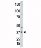 Western blot testing of CDX2 antibody and human placenta tissue lysate. Predicted molecular weight: 33-40 kDa.