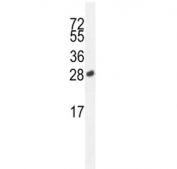 ICOS antibody western blot analysis in Jurkat lysate. Predicted molecular weight ~23 kDa.