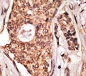 IHC analysis of FFPE human lymph node with ICOS antibody