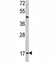 Western blot analysis of Leptin antibody MDA-MB231 lysate. Predicted molecular weight ~16 kDa.