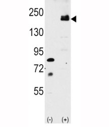 Western blot analysis of LRP6 antibody and 293 cell lysate either nontransfected or transiently transfected with the LRP6 gene.~
