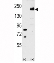 Western blot analysis of LRP6 antibody and 293 cell lysate either nontransfected or transiently transfected with the LRP6 gene.