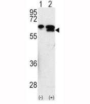 Western blot analysis of MMP3 antibody and 293 cell lysate either nontransfected (Lane 1) or transiently transfected with the MMP3 gene (2). Predicted molecular weight ~54kDa.