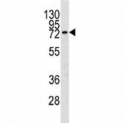 Western blot analysis of MMP9 in mouse spleen lysate. Predicted molecular weight: 92/67-80 kDa (precursor/mature forms).