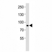 Western blot analysis of lysate from NCI-H1299 cell line using MMP9 antibody at 1:1000. Predicted molecular weight: 92/67-80 kDa (precursor/mature forms).
