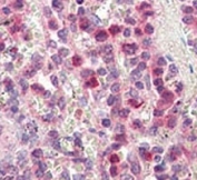 IHC analysis of FFPE human spleen tissue stained with MMP9 antibody