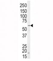 Western blot analysis of NRG1 antibody and SK-BR-3 lysate. Predicted molecular weight of multiple isofoms: 26-70 kDa.