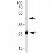 SIRT3 antibody western blot analysis in HepG2 lysate. Predicted size: 44/28 kDa (full/processed)