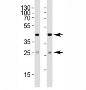 Western blot analysis of lysate from (1) 293 and (2) HepG2 cell line using SIRT3 antibody at 1:1000. Predicted size: 44/28 kDa (full/processed)