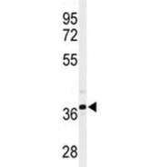 Western blot analysis of SIRT3 antibody and CHO lysate