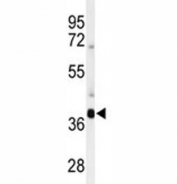 Western blot analysis of SIRT3 antibody and mouse brain tissue lysate