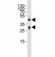 Western blot analysis of lysate from mouse heart tissue lysate using SIRT3 antibody diluted at 1:1000.