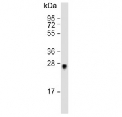 Western blot analysis of SIRT3 antibody and mouse liver lysate