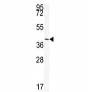 Western blot analysis of SIRT6 antibody and mouse stomach tissue lysate