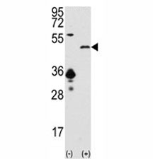 Western blot analysis of SIRT7 antibody and 293 cell lysate (2 ug/lane) either nontransfected (Lane 1) or transiently transfected with the SIRT7 gene (2).~