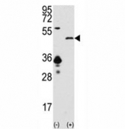 Western blot analysis of SIRT7 antibody and 293 cell lysate (2 ug/lane) either nontransfected (Lane 1) or transiently transfected with the SIRT7 gene (2).