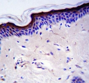 TP53 antibody immunohistochemistry analysis in formalin fixed and paraffin embedded human skin tissue.