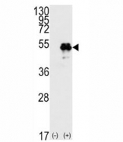 Western blot analysis of TP53 antibody and 293 cell lysate (2 ug/lane) either nontransfected (Lane 1) or transiently transfected with the TP53 gene (2).