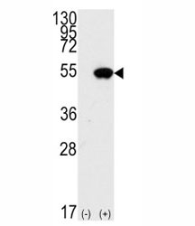 Western blot analysis of p53 antibody and 293 cell lysate (2 ug/lane) either nontransfected (Lane 1) or transiently transfected with the TP53 gene (2).~