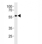 p53 antibody western blot analysis in Daudi lysate.