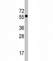 Western blot analysis of CDC6 antibody in Ramos lysate. Predicted molecular weight ~62 kDa.